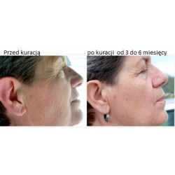 2Atomizer z wodą jednocząsteczkową KAS-ATM