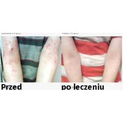 2Wizyta w gabinecie naturoterapii