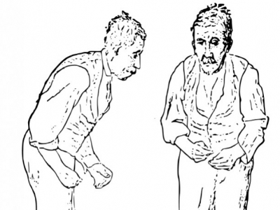 Próba inhalacji wodoru w chorobie Parkinsona: badanie pilotażowe