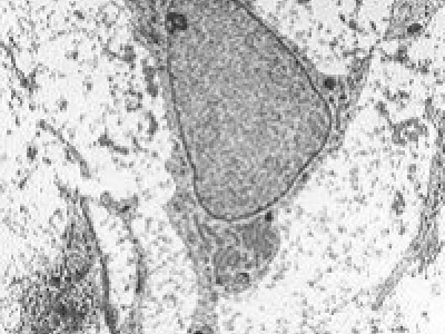 Mezenchyma co to takiego i dlaczego jest ważna