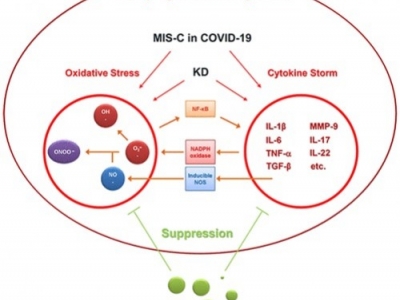 Chemiczne i biochemiczne aspekty wodoru molekularnego w leczeniu choroby Kawasak