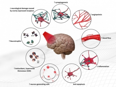 Wpływ jednoczesnego stosowania wody H2 i fotobiomodulacji na chorobę Parkinsona