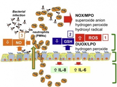 Stres oksydacyjny i terapia antyoksydacyjna w mukowiscydozie.