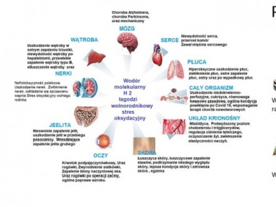  Postępy w medycynie wodorowej: