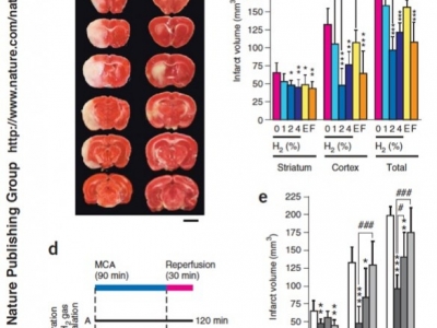 Wodór: Nowy Gaz Medyczny