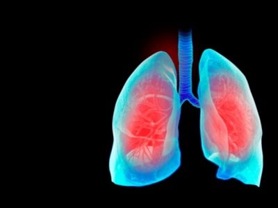 Właściwości ochronne wodoru molekularnego  na płuca i inne narządy